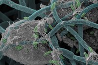 Interaction of bacteria and saccharomyces albicans in the gut