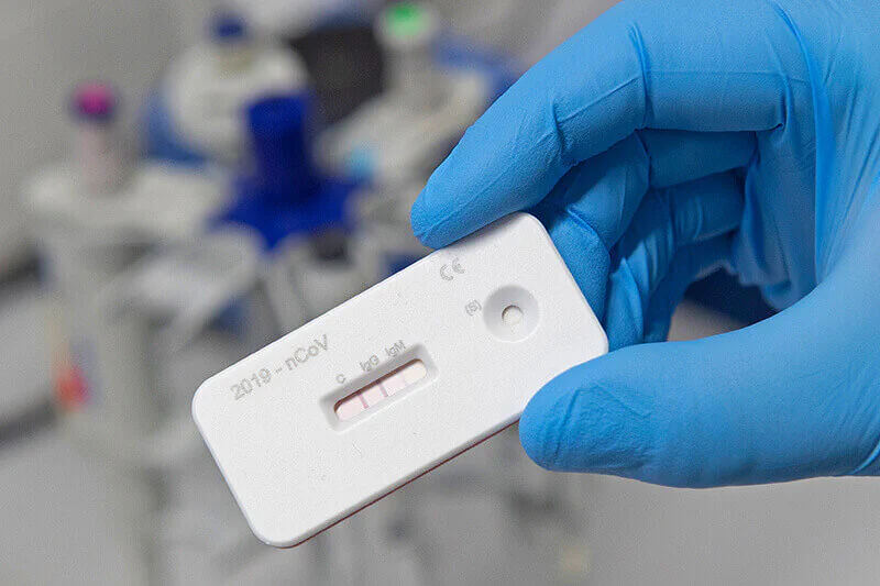 Senova entwickelt Corona-Schnelltest, Bild: Infectognostics / Jens Meyer  Senova entwickelt Corona-Schnelltest, Bild: Infectognostics / Jens Meyer